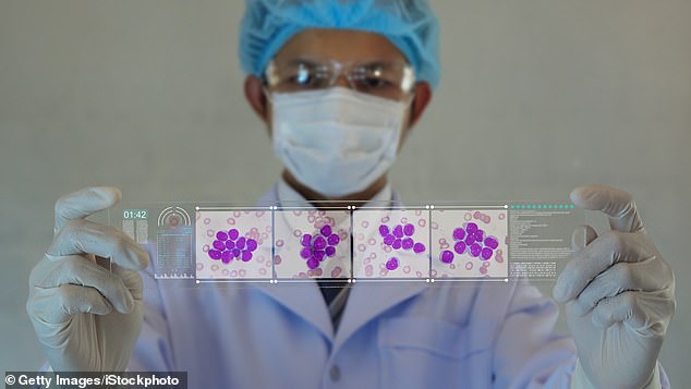 Die Behandlung wird nur Menschen empfohlen, die bereits an Krebs im Endstadium leiden, der sie wahrscheinlich sowieso töten wird, da sie so riskant ist.  Es erfordert auch Stammzellen von nordeuropäischen Menschen mit einer sehr spezifischen Mutation, die sie resistent gegen HIV macht (Dateifoto)