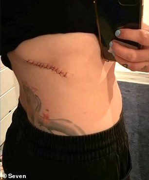 Frau Bourke erholt sich jetzt von der Operation