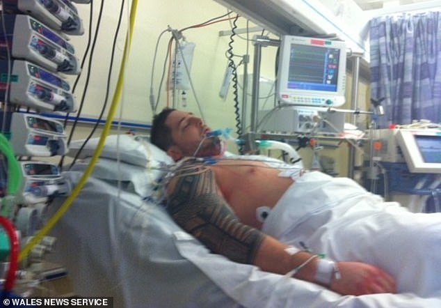 Durch den Herzinfarkt verlor er 50 Prozent des Muskelgewebes des Organs und bedeutete, dass Mediziner eine mechanische Pumpe namens Left Ventricular Assist Device installieren mussten, um sein Herz am Laufen zu halten