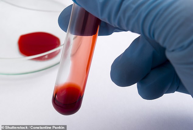 Handelt es sich um eine Hämochromatose, besteht die Behandlung zunächst darin, einmal pro Woche etwa 500 ml Blut zu entnehmen (derselbe Vorgang wie bei einer Blutspende), bis die Eisenvorräte normal sind