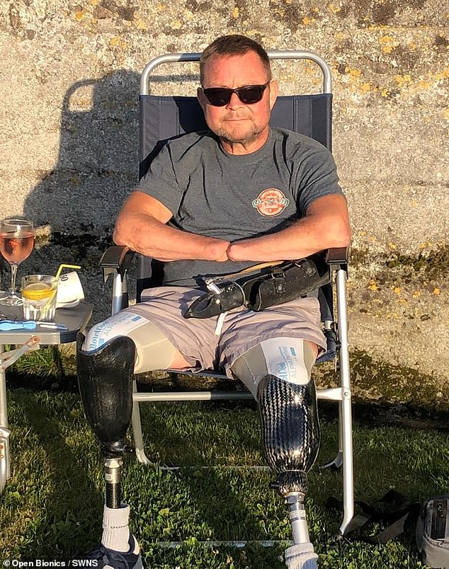 Herr White aus Fleet in Hampshire hatte so große Schmerzen von seinen „sterbenden“ Gliedmaßen, die schwarz geworden waren, dass er Mediziner anflehte, ihm die Hände abzuschneiden. Rund 30 Operationen musste er über sich ergehen lassen, was bedeutete, dass Ärzte ihm beide Beine und Hände amputieren mussten
