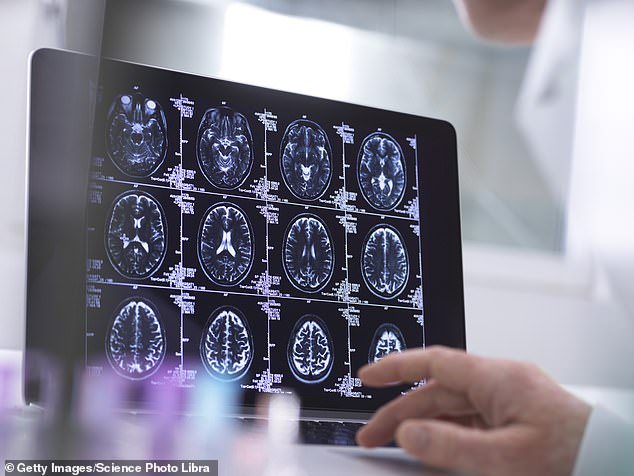 Studien zeigen, dass etwa die Hälfte aller Fälle der neurologischen Störung ¿ die unfreiwilliges Verhalten verursacht ¿ nicht diagnostiziert wird, wodurch Tausende ohne lebenswichtige Unterstützung bleiben