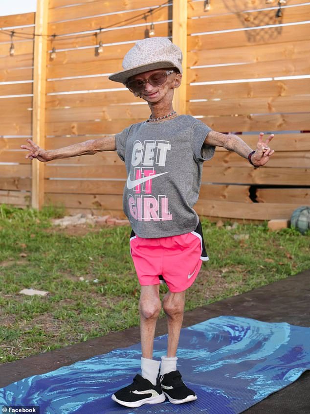 Dr. James Liu, ein Genetiker, der es entwickelt hat, sagte, das Ger&auml;t k&ouml;nne verwendet werden, um Patienten wie Adalia Rose (im Bild) zu helfen, die im Alter von 15 Jahren an der genetischen Erkrankung Progerie starb, die dazu f&uuml;hrt, dass der K&ouml;rper schnell altert und nicht normal w&auml;chst