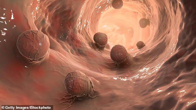 Obwohl die Ergebnisse der Studie bahnbrechend sind, stellen die Forscher fest, dass die Stichprobengröße relativ klein war und es mehr Forschung erfordern wird, um festzustellen, ob sie tatsächlich auf eine Krebsheilung gestoßen sind (Archivfoto).