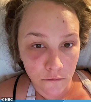 Die Mutter ist oben kurz nach der Operation abgebildet