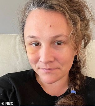 Das Blut, das die blockierte Arterie hinunterfließt, wurde jetzt umgeleitet, um durch ihre Kopfhaut zu fließen