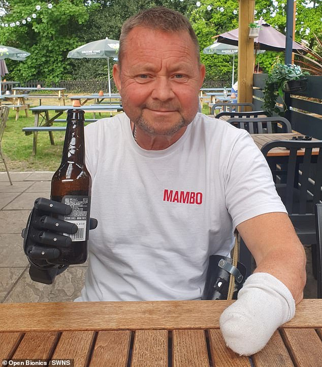 Michael White, 55, verlor alle vier Gliedmaßen aufgrund einer seltenen entzündlichen Erkrankung, konnte aber dank seiner neuen Roboter-Gliedmaßen etwas Pool schießen und einen Schluck eiskaltes Bier trinken