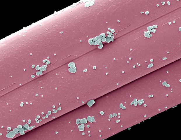 Biologisch abbaubare Transport-Nanopartikel können entzündungshemmende Medikamente wirksamer und weniger toxisch machen