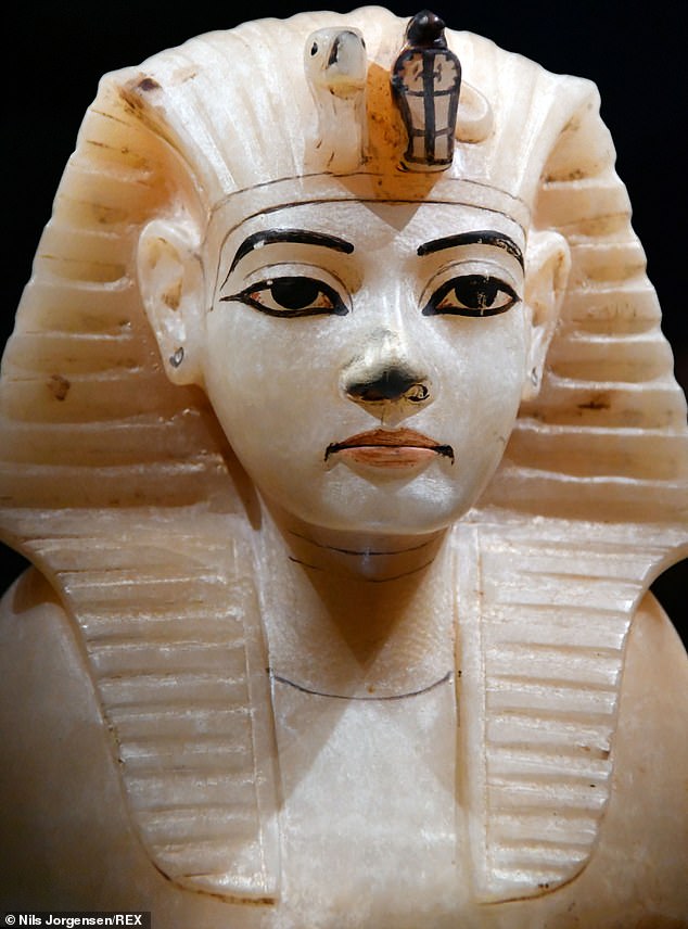 Das Leben von Patienten mit Hirnverletzungen wird dank einer Operation im altägyptischen Stil gerettet, bei der ein Loch in ihren Schädel gebohrt wird, um Schwellungen zu reduzieren