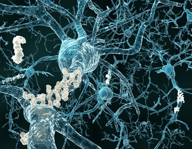 Die Entdeckung könnte die Suche nach neuen Alzheimer-Medikamenten beeinflussen