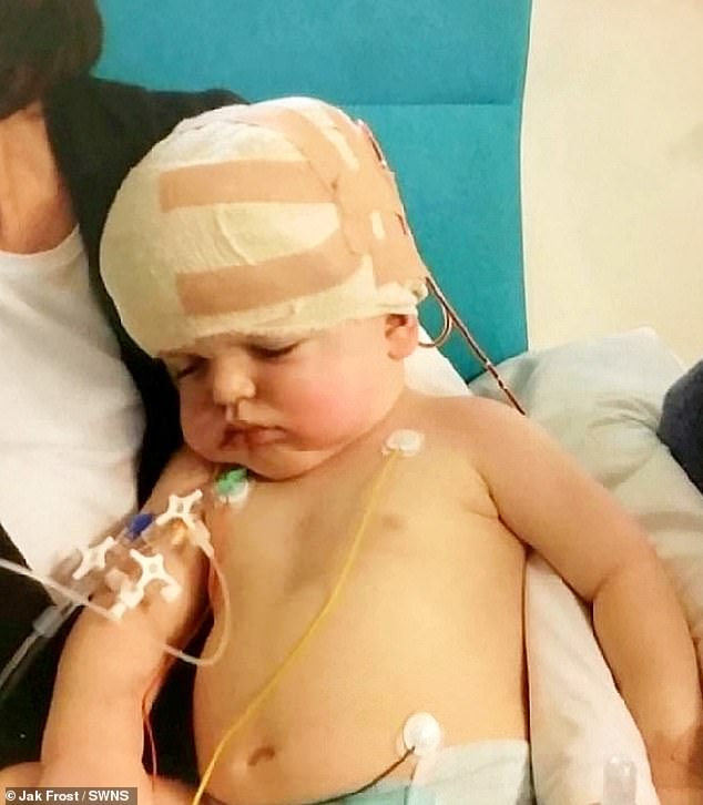 Der Schädel des Schuljungen wurde nach einer lebensrettenden Operation „wie ein Puzzle“ wieder zusammengesetzt, um zu verhindern, dass sein Gehirn zerquetscht wird