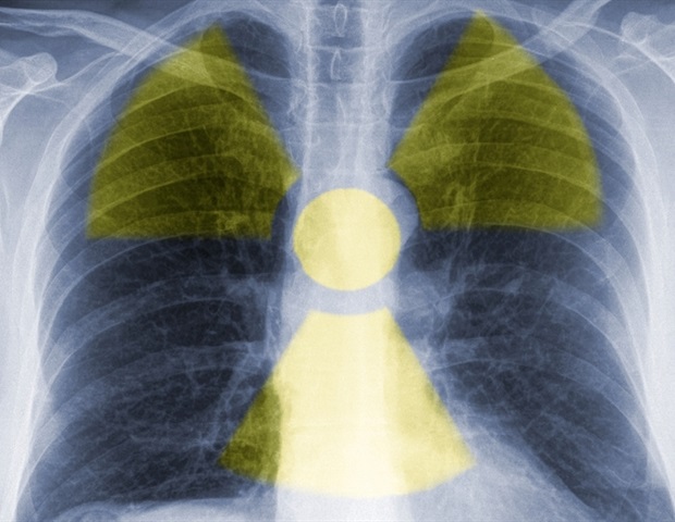 Neuartiger Radiotracer für molekulare Bildgebung kann mehrere Krebsarten präzise diagnostizieren