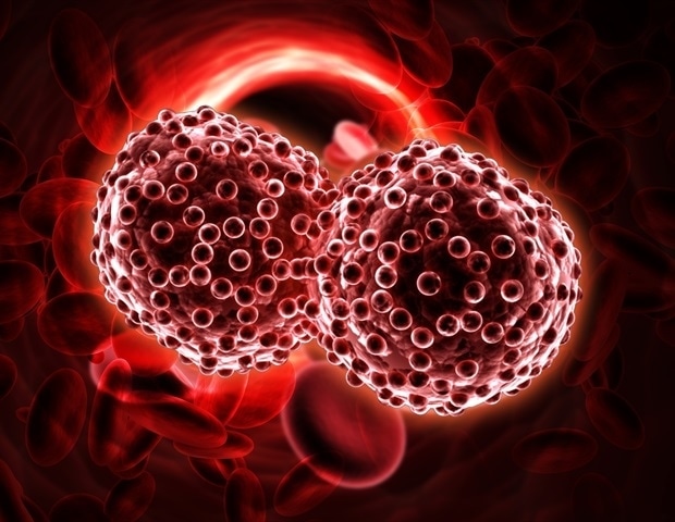 Forscher identifizieren Therapien für Patienten mit multiplem Myelom, deren Krebs nach CAR-T zurückfällt