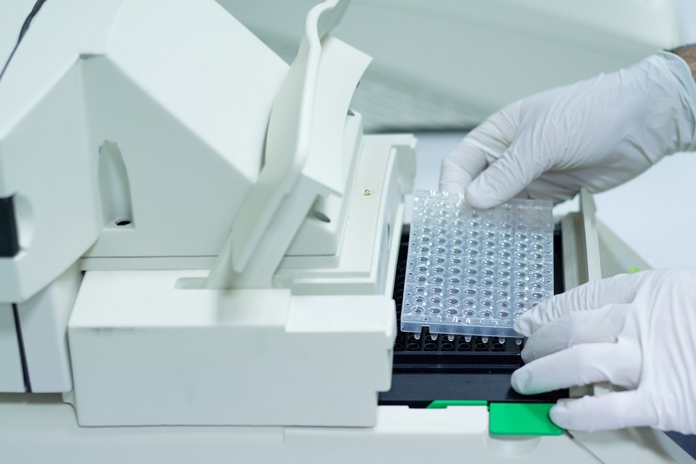 Die Studie kommt zu dem Schluss, dass das Affenpockenvirus leicht durch qPCR mit drei klinisch validierten Assays nachgewiesen werden kann