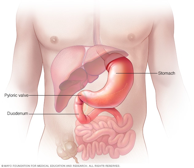 Magen, Pylorusklappe und oberer Teil des Dünndarms (Duodenum)