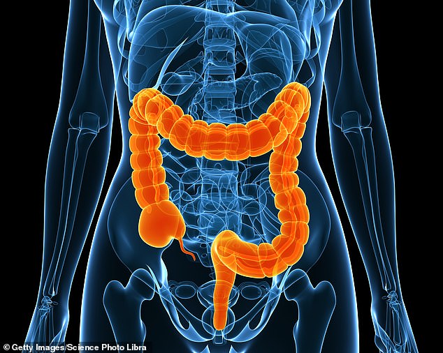 Eine einmal täglich eingenommene Tablette kann eine schwere Darmerkrankung mit Colitis ulcerosa in nur drei Monaten beseitigen