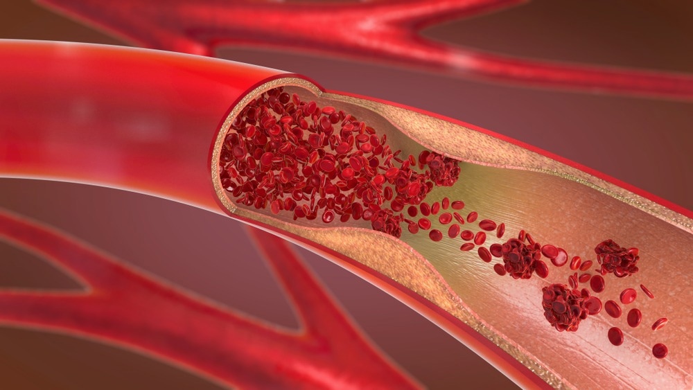 Forscher stellen ein nicht poröses, biologisch abbaubares Gefäßtransplantat her