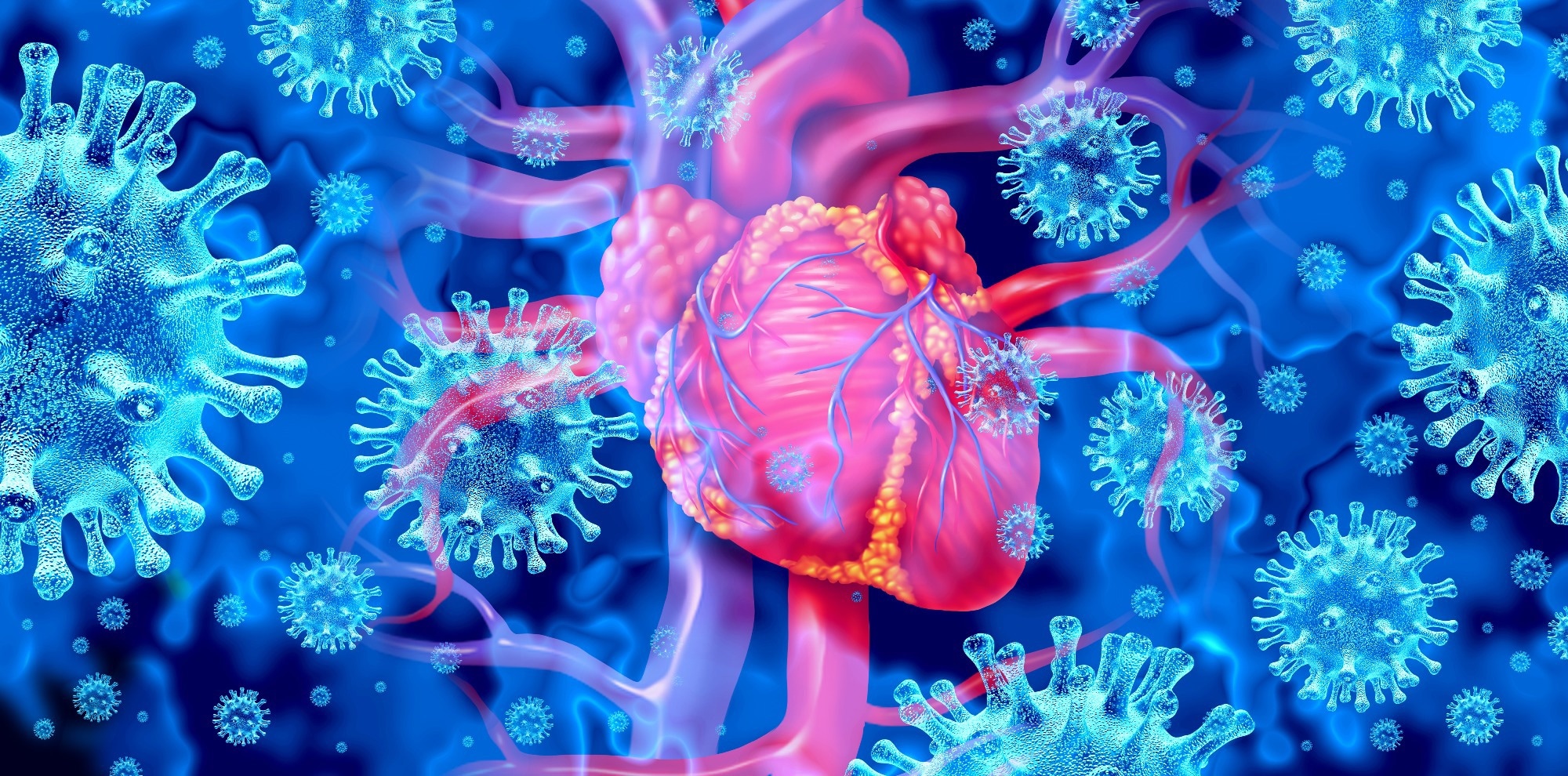 Myokarditis kann auf eine Affenpockeninfektion zurückzuführen sein