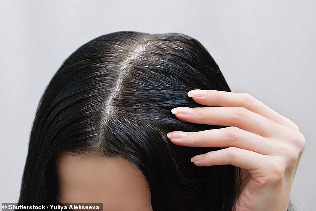 Was ist das beste Mittel gegen eine schuppige, juckende Kopfhaut?  DR. MARTIN SCURR beantwortet Ihre Gesundheitsfragen