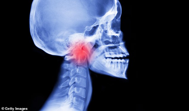 Wie Patienten in Qualen zurückgelassen werden, wenn der NHS Mandeloperationen einschränkt: Früher war es eine Routineoperation … jetzt wird sie rationiert – aber am Ende kostet die Behandlung mehr